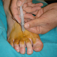 CIRUGIA